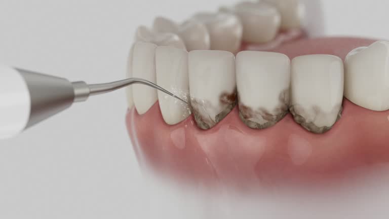 Reliable Dental contractor in Montgomery County County, IN by Dentist Open Now